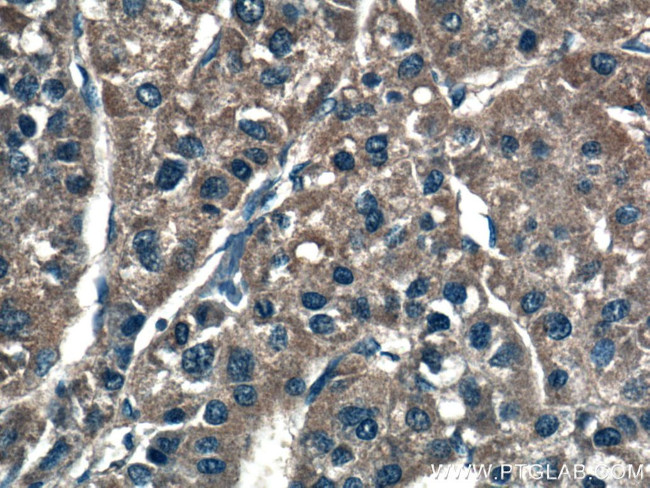 VEGF Receptor 2 Antibody in Immunohistochemistry (Paraffin) (IHC (P))