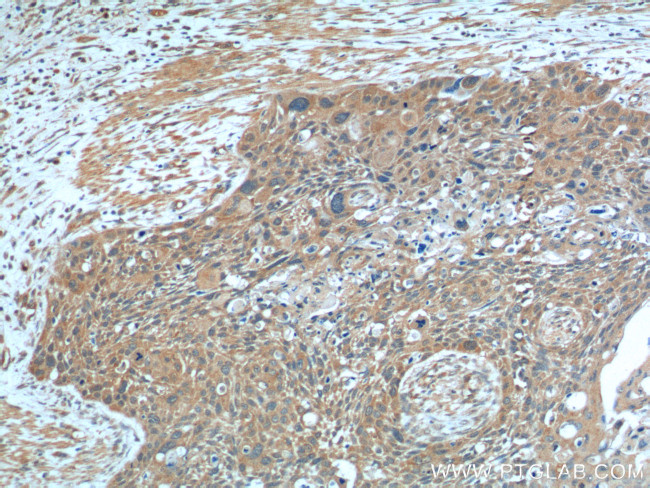 VEGF Receptor 2 Antibody in Immunohistochemistry (Paraffin) (IHC (P))