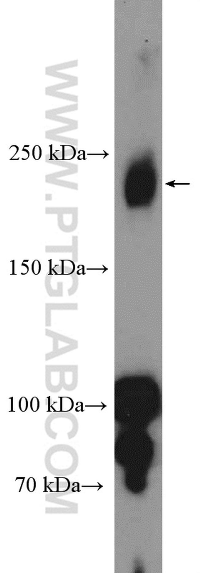 VEGF Receptor 2 Antibody in Western Blot (WB)