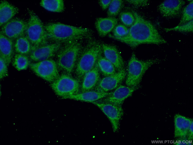 C6orf150 Antibody in Immunocytochemistry (ICC/IF)