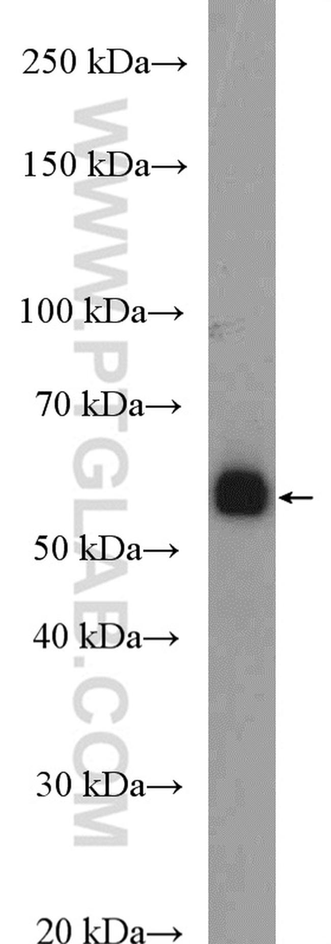 C6orf150 Antibody in Western Blot (WB)