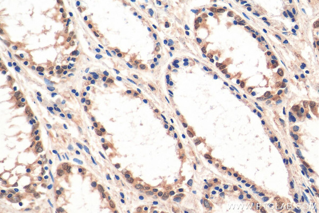 C6orf150 Antibody in Immunohistochemistry (Paraffin) (IHC (P))