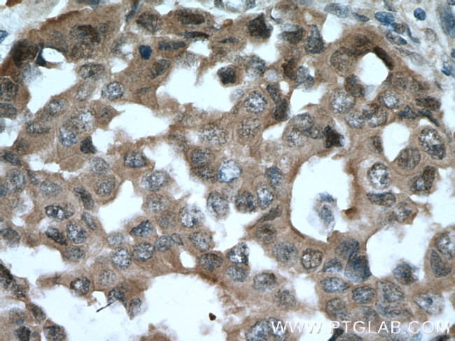 BAG6 Antibody in Immunohistochemistry (Paraffin) (IHC (P))