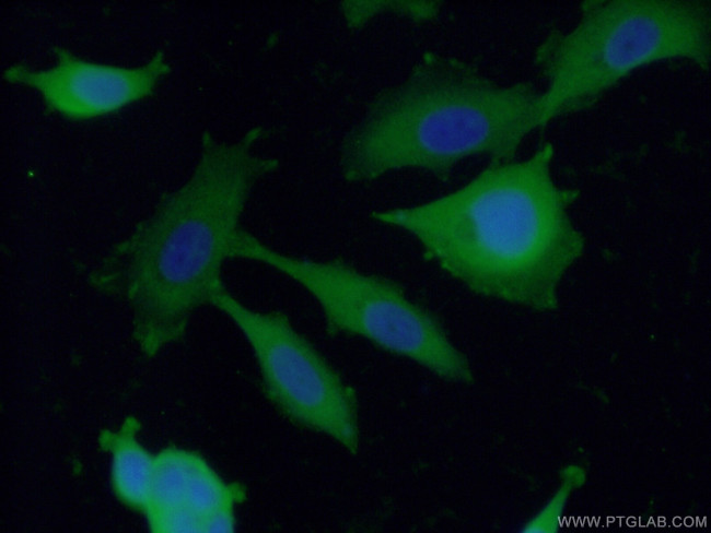 ENAH Antibody in Immunocytochemistry (ICC/IF)