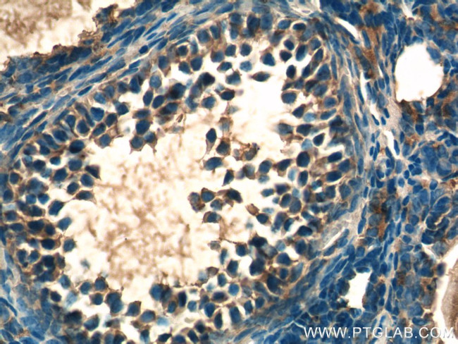 LHCGR Antibody in Immunohistochemistry (Paraffin) (IHC (P))