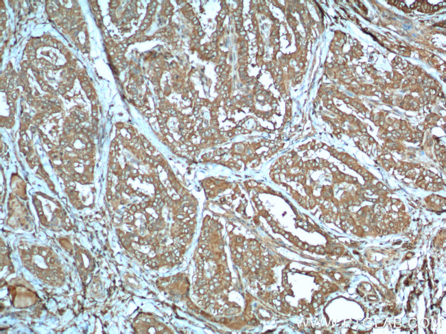 LHCGR Antibody in Immunohistochemistry (Paraffin) (IHC (P))