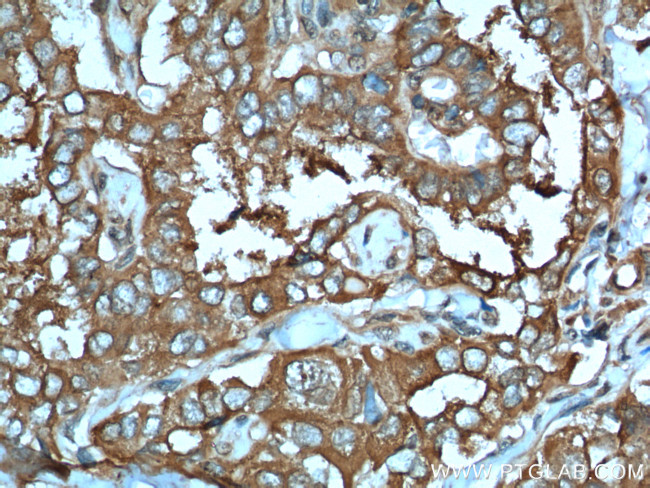 LHCGR Antibody in Immunohistochemistry (Paraffin) (IHC (P))