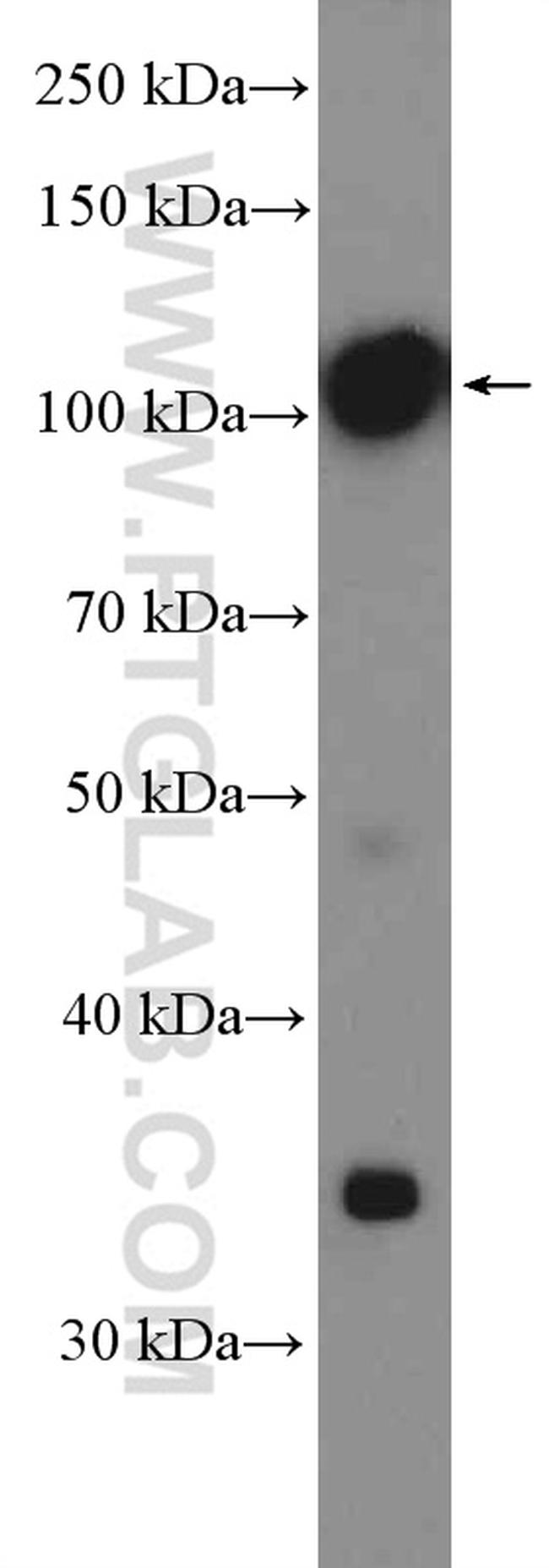 LHCGR Antibody in Western Blot (WB)