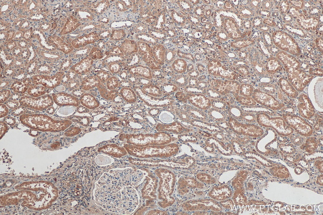 ZDHHC12 Antibody in Immunohistochemistry (Paraffin) (IHC (P))