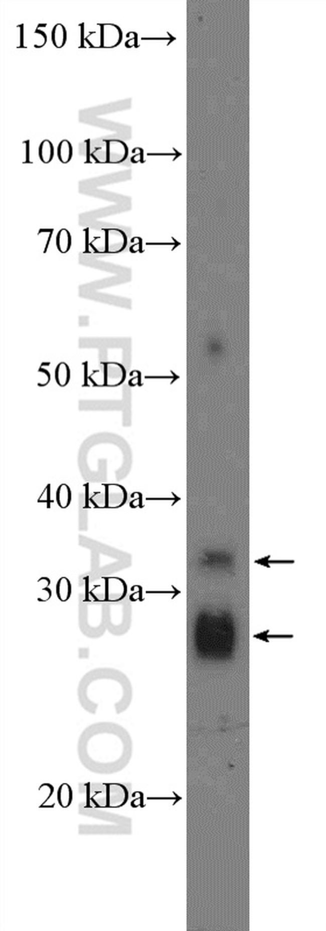 ZDHHC12 Antibody in Western Blot (WB)
