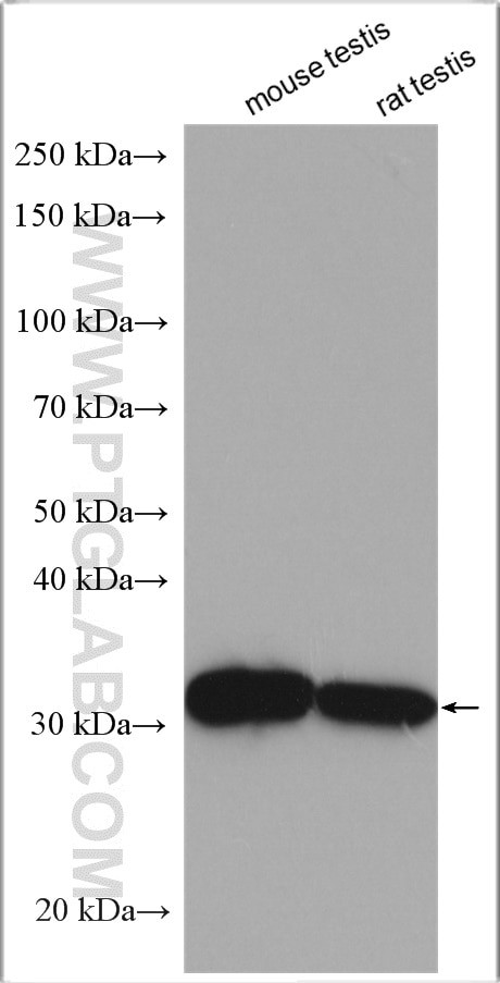 Enkurin Antibody in Western Blot (WB)