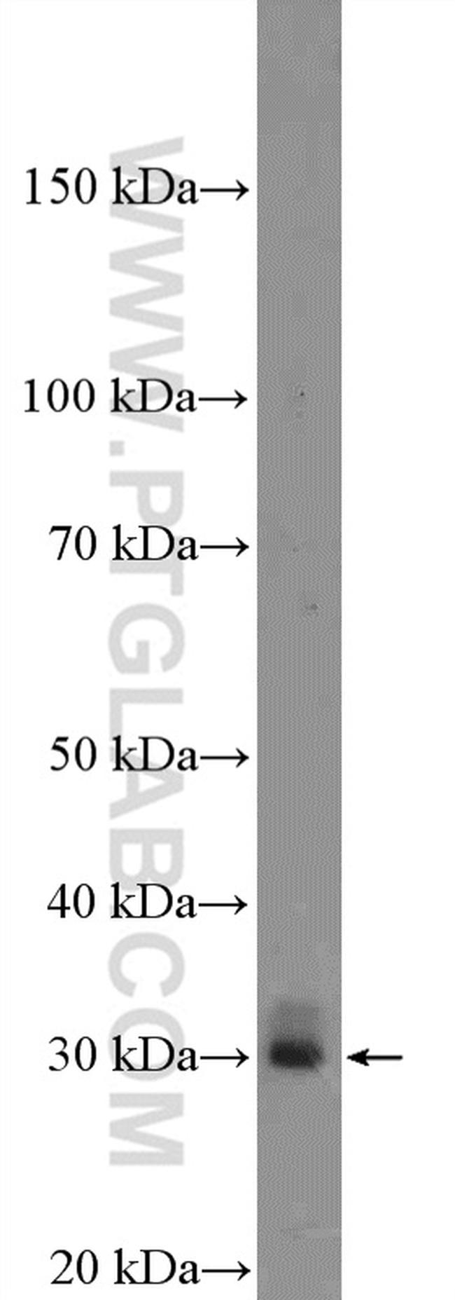 Enkurin Antibody in Western Blot (WB)