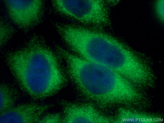 SFRP1 Antibody in Immunocytochemistry (ICC/IF)