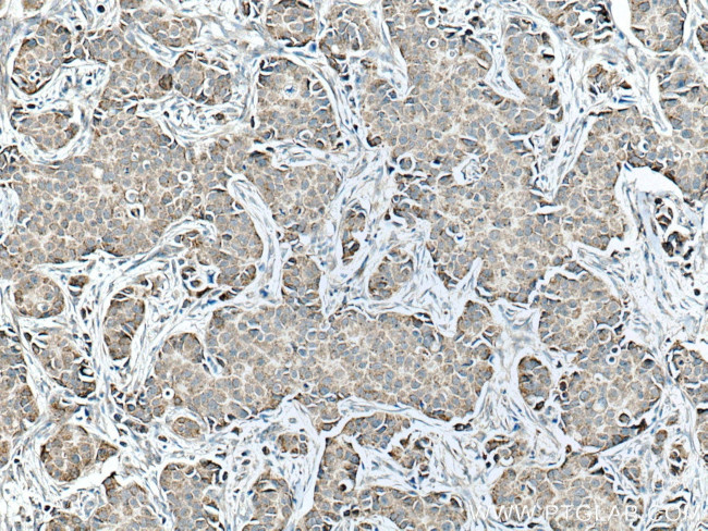 SFRP1 Antibody in Immunohistochemistry (Paraffin) (IHC (P))