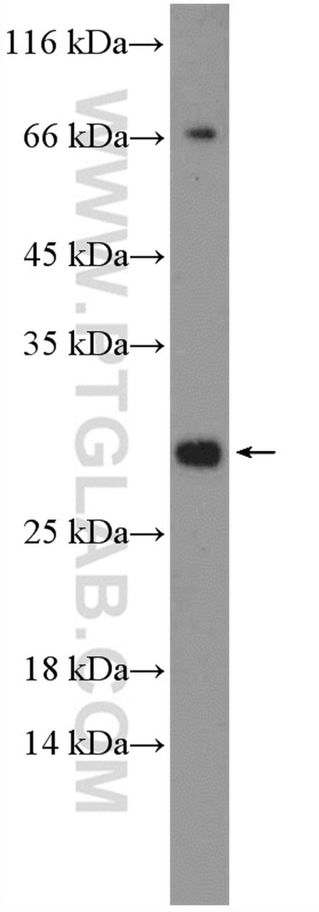 EAF6 Antibody in Western Blot (WB)