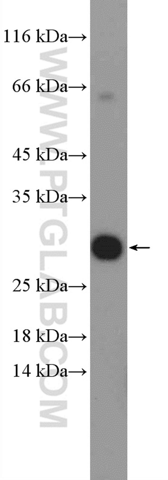 EAF6 Antibody in Western Blot (WB)