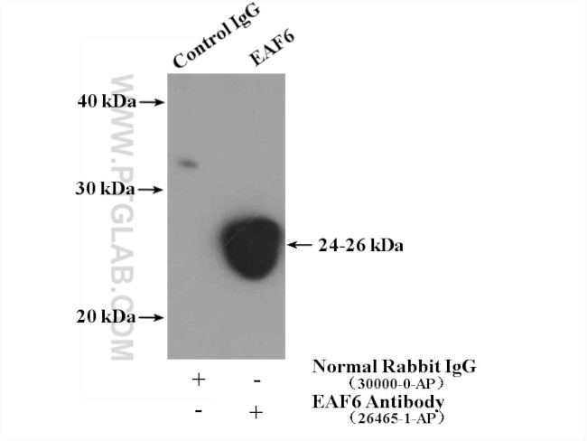 EAF6 Antibody in Immunoprecipitation (IP)