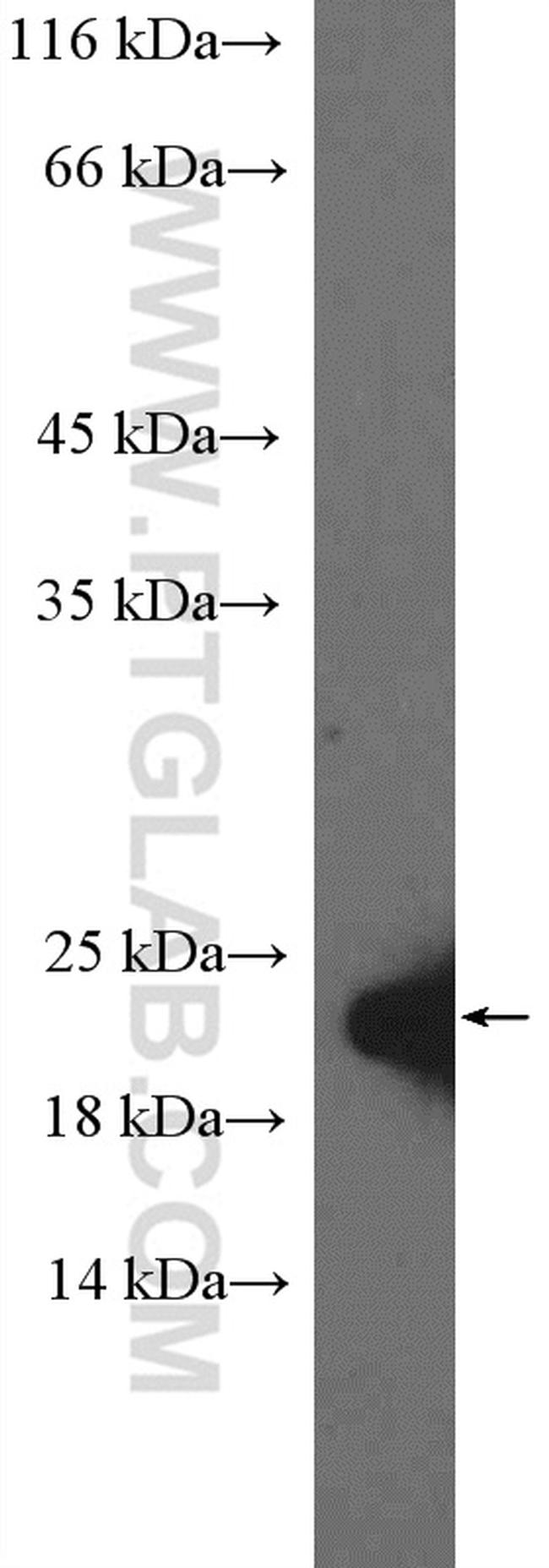 EAF6 Antibody in Western Blot (WB)