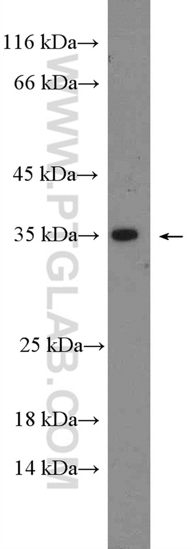 Mitoferrin 1 Antibody in Western Blot (WB)