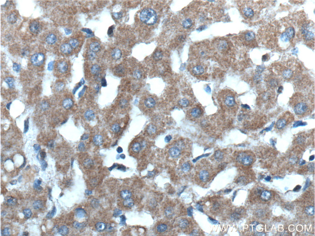 Mitoferrin 1 Antibody in Immunohistochemistry (Paraffin) (IHC (P))