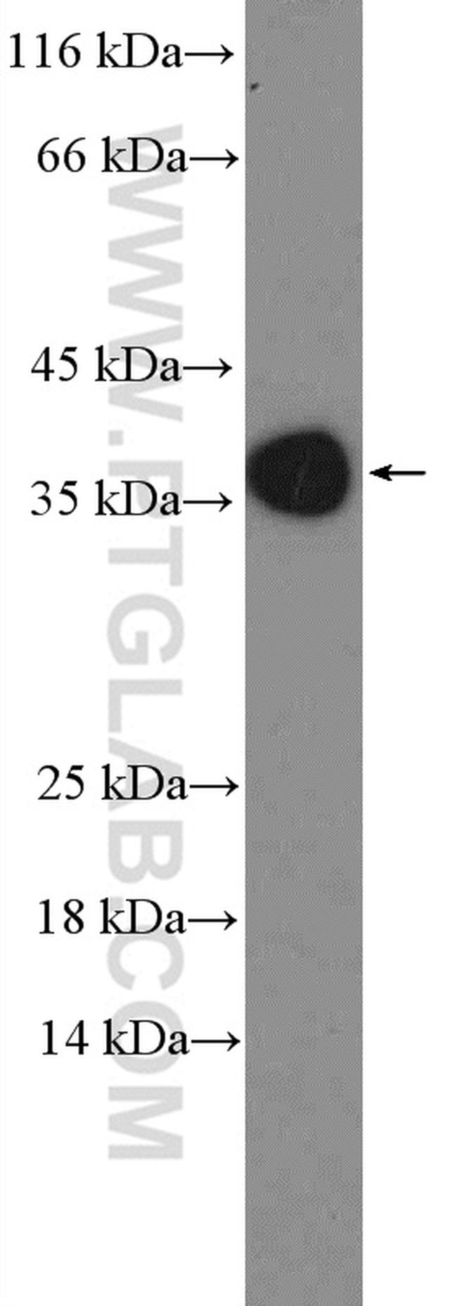 Mitoferrin 1 Antibody in Western Blot (WB)