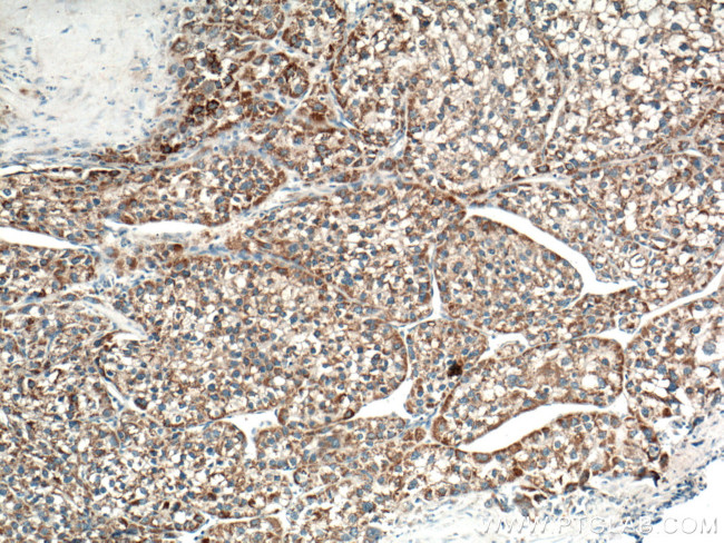 OTC Antibody in Immunohistochemistry (Paraffin) (IHC (P))