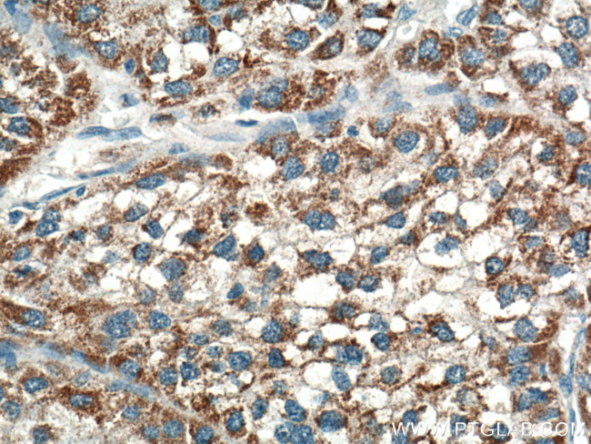 OTC Antibody in Immunohistochemistry (Paraffin) (IHC (P))