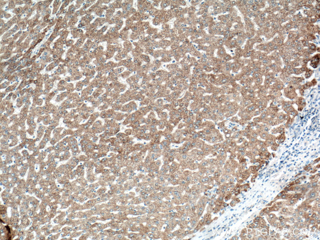 OTC Antibody in Immunohistochemistry (Paraffin) (IHC (P))