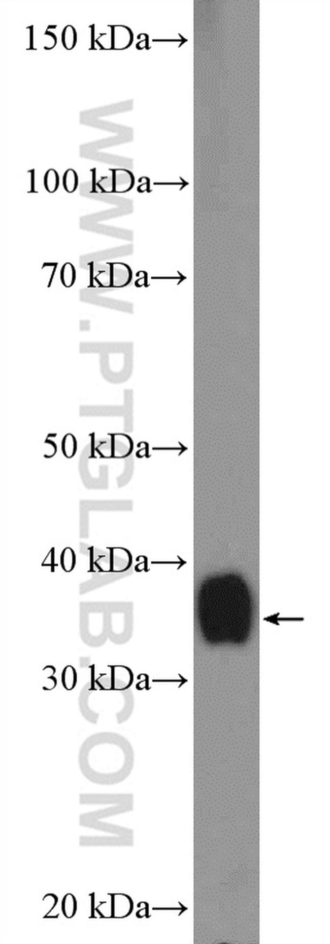 OTC Antibody in Western Blot (WB)