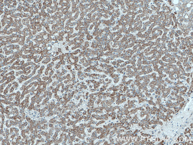 SLC2A9 Antibody in Immunohistochemistry (Paraffin) (IHC (P))