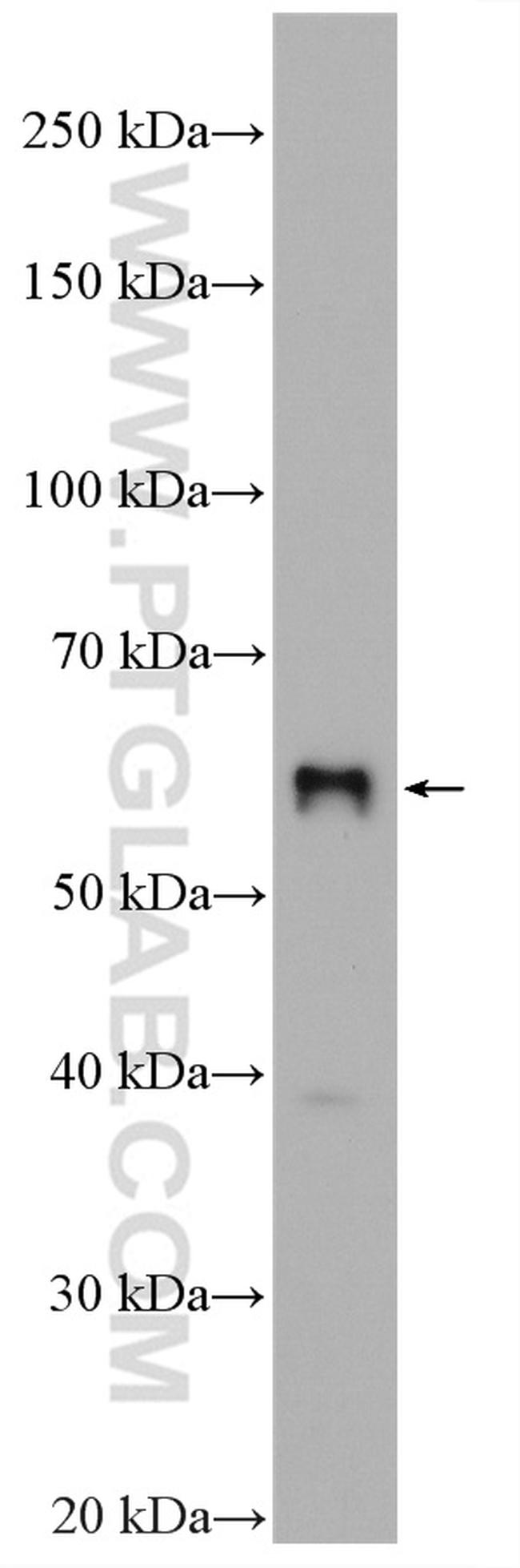 SLC2A9 Antibody in Western Blot (WB)