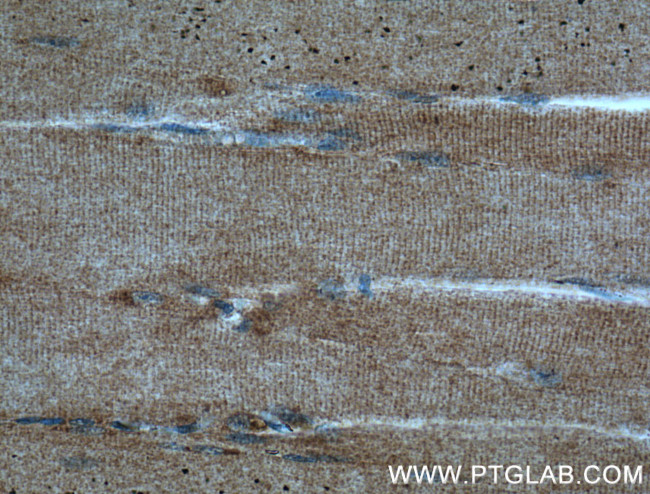 DIO2 Antibody in Immunohistochemistry (Paraffin) (IHC (P))