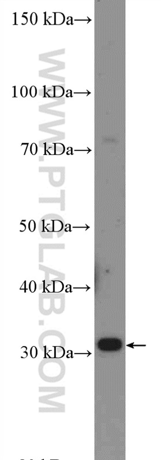 DIO2 Antibody in Western Blot (WB)