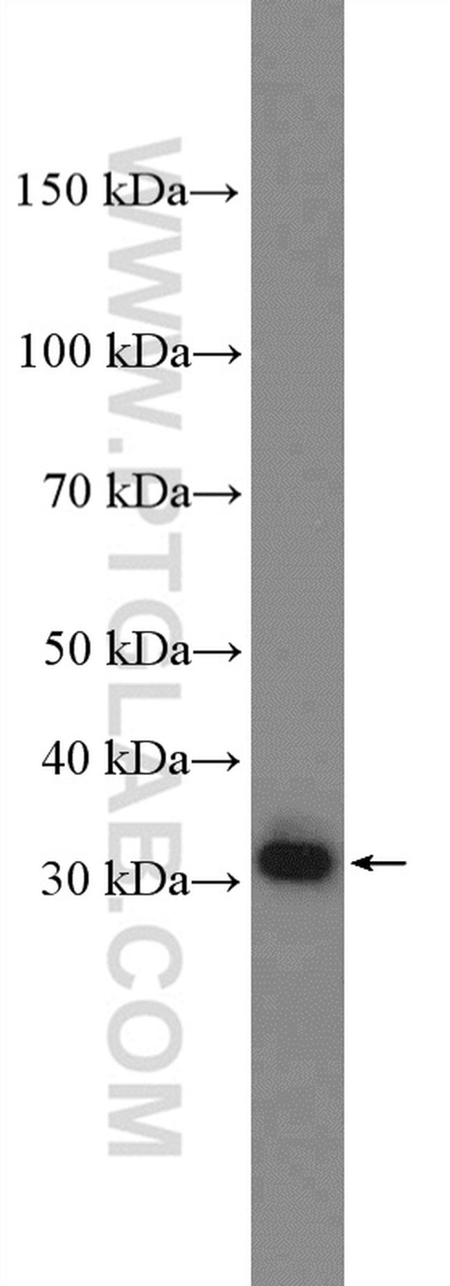 DIO2 Antibody in Western Blot (WB)