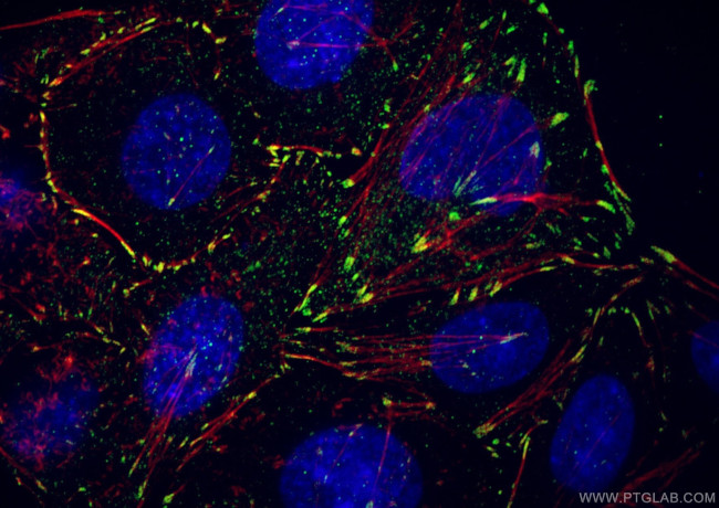 Vinculin Antibody in Immunocytochemistry (ICC/IF)