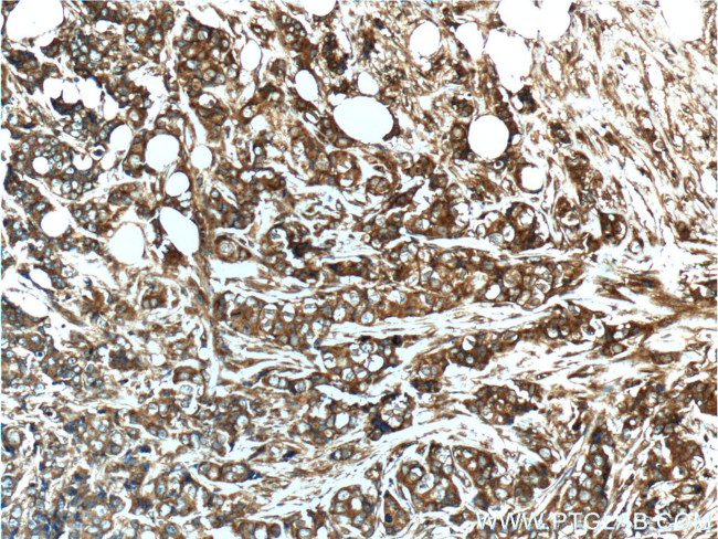 Vinculin Antibody in Immunohistochemistry (Paraffin) (IHC (P))