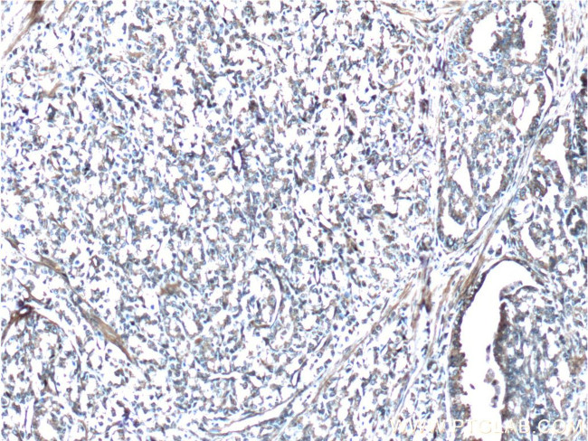 Vinculin Antibody in Immunohistochemistry (Paraffin) (IHC (P))