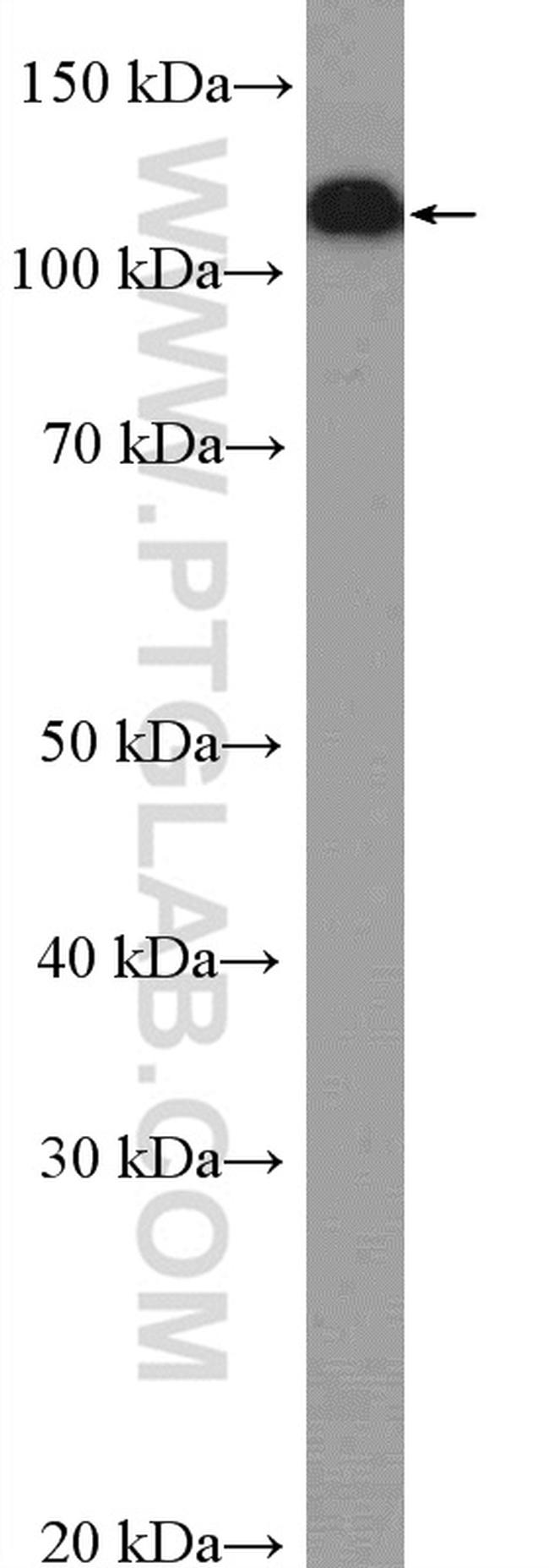 Vinculin Antibody in Western Blot (WB)