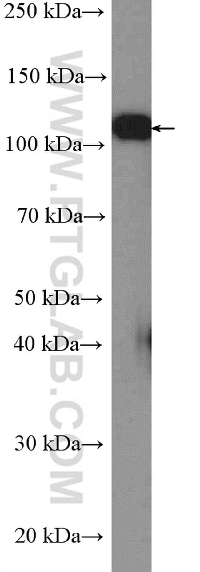 Vinculin Antibody in Western Blot (WB)