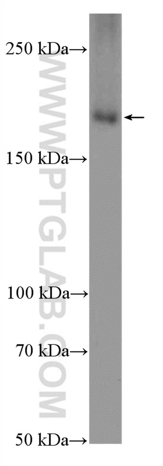 CLTC Antibody in Western Blot (WB)