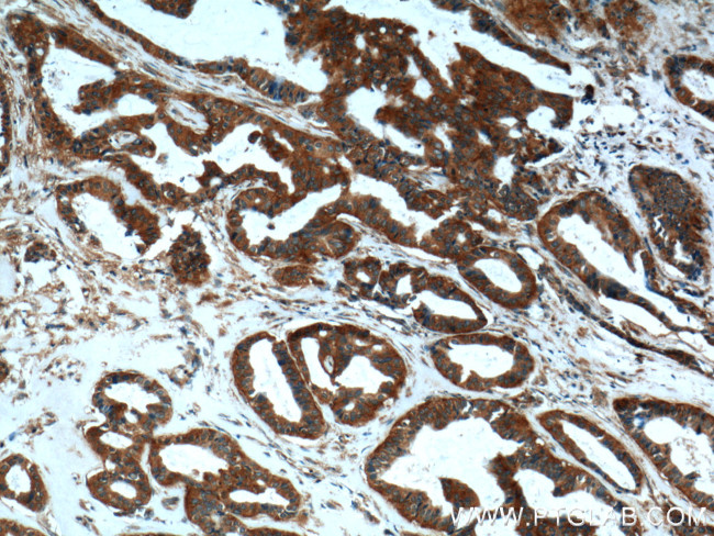 CLTC Antibody in Immunohistochemistry (Paraffin) (IHC (P))