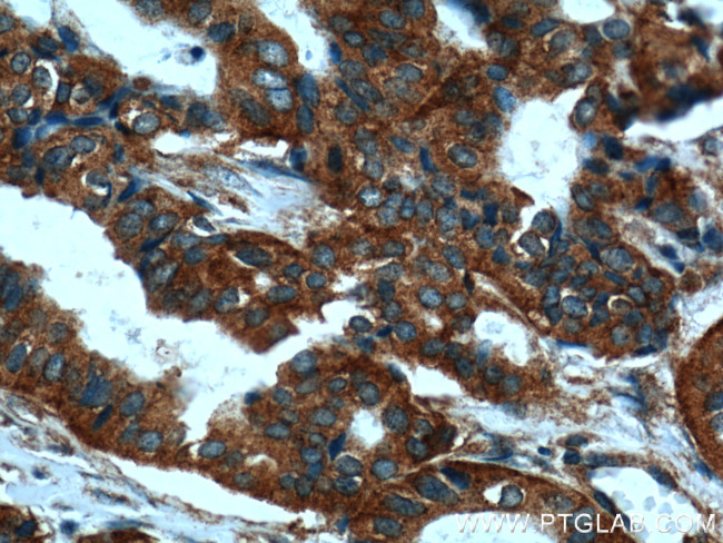 CLTC Antibody in Immunohistochemistry (Paraffin) (IHC (P))