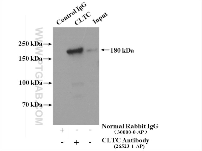 CLTC Antibody in Immunoprecipitation (IP)