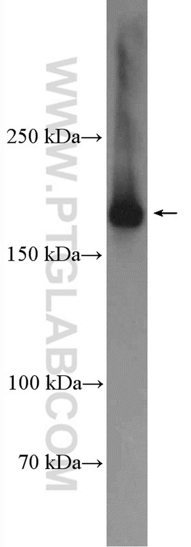 CLTC Antibody in Western Blot (WB)