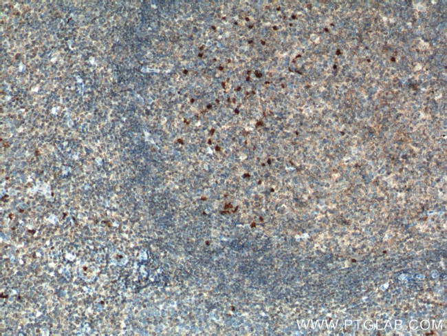 MIP-3 alpha Antibody in Immunohistochemistry (Paraffin) (IHC (P))