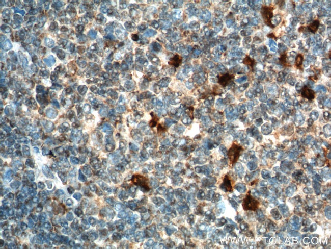 MIP-3 alpha Antibody in Immunohistochemistry (Paraffin) (IHC (P))