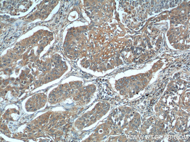 MIP-3 alpha Antibody in Immunohistochemistry (Paraffin) (IHC (P))