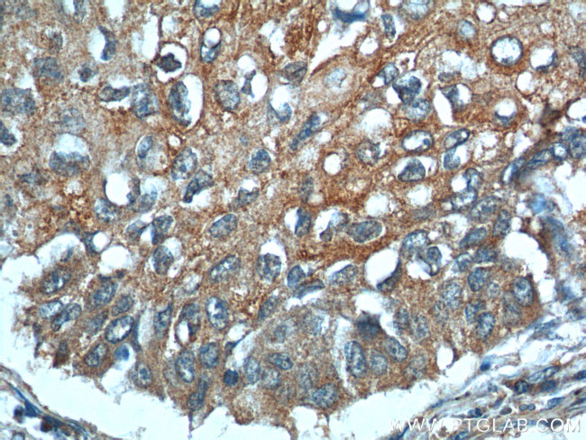 MIP-3 alpha Antibody in Immunohistochemistry (Paraffin) (IHC (P))