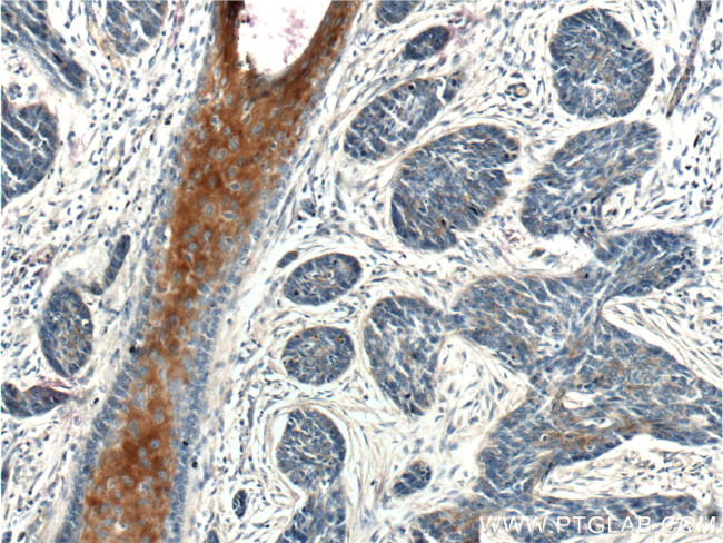 XYLB Antibody in Immunohistochemistry (Paraffin) (IHC (P))