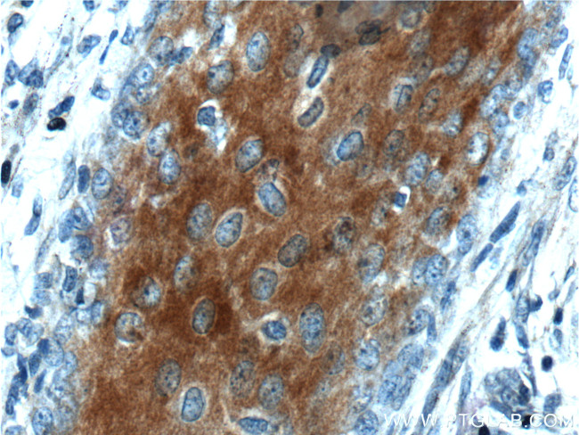 XYLB Antibody in Immunohistochemistry (Paraffin) (IHC (P))